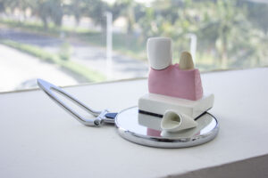 cosmetica dental coronas dentales en cancun