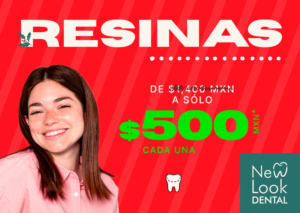 Resinas dentales $500