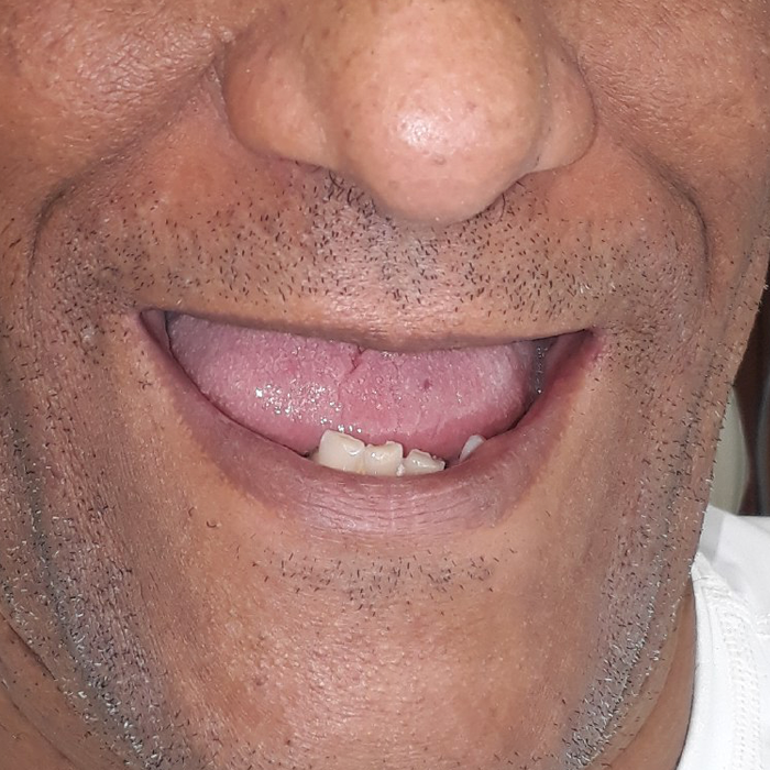 dentista en cancun quintana roo isla mujeres cozumel playa del carmen