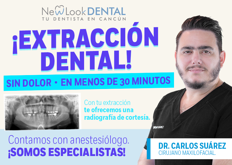 Extracción dental en menos de 30 minutos