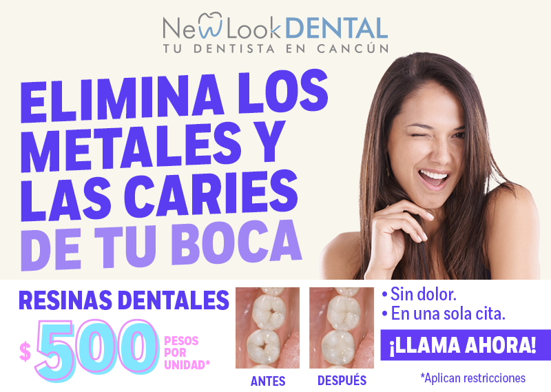 Resinas dentales $500 pesos