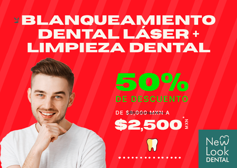 Blanqueamiento Dental Laser y Limpieza Dental 50%